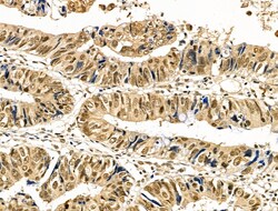 Invitrogen Phospho-Cyclin E (Thr73) Polyclonal Antibody 100 &mu;L; Unconjugated:Antibodies,