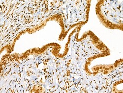 Invitrogen Phospho-Cyclin E (Thr73) Polyclonal Antibody 100 &mu;L; Unconjugated:Antibodies,