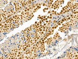 Invitrogen Phospho-Cyclin E (Thr73) Polyclonal Antibody 100 &mu;L; Unconjugated:Antibodies,