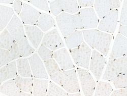 Invitrogen Phospho-CAD (Ser1859) Polyclonal Antibody 100 &mu;L | Buy Online | Invitrogen&trade; | Fisher Scientific