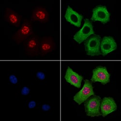 Invitrogen Phospho-AKT1 (Ser124) Polyclonal Antibody 100 &mu;L; Unconjugated:Antibodies,