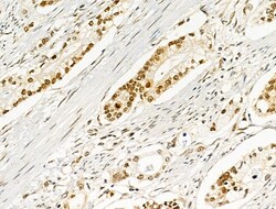 Invitrogen Phospho-AKT1 (Ser124) Polyclonal Antibody 100 &mu;L; Unconjugated:Antibodies,