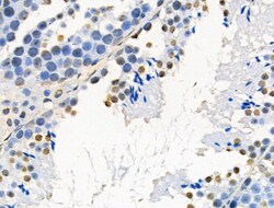 Invitrogen Phospho-AKT1 (Ser124) Polyclonal Antibody 100 &mu;L; Unconjugated:Antibodies,