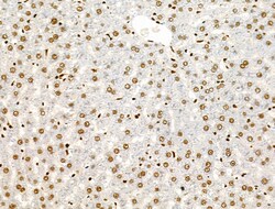 Invitrogen Phospho-AKT1 (Ser124) Polyclonal Antibody 100 &mu;L; Unconjugated:Antibodies,
