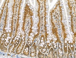 Invitrogen Phospho-AKT1 (Ser124) Polyclonal Antibody 100 &mu;L; Unconjugated:Antibodies,