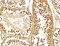 Invitrogen Phospho-AKT1 (Ser124) Polyclonal Antibody 100 &mu;L; Unconjugated:Antibodies,