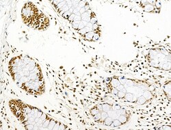 Invitrogen Phospho-AKT1 (Ser124) Polyclonal Antibody 100 &mu;L; Unconjugated:Antibodies,