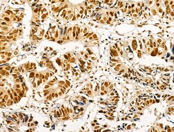 Invitrogen Phospho-AKT1 (Ser124) Polyclonal Antibody 100 &mu;L; Unconjugated:Antibodies,
