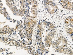 Invitrogen Phospho-AKT1 (Ser124) Polyclonal Antibody 100 &mu;L; Unconjugated:Antibodies,