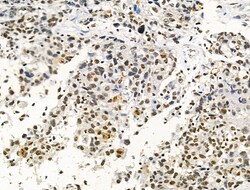 Invitrogen Phospho-AKT1 (Ser124) Polyclonal Antibody 100 &mu;L; Unconjugated:Antibodies,
