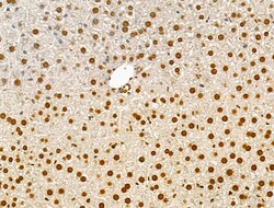 Invitrogen Phospho-AKT1 (Ser124) Polyclonal Antibody 100 &mu;L; Unconjugated:Antibodies,