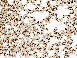 Invitrogen Phospho-AKT1 (Ser124) Polyclonal Antibody 100 &mu;L; Unconjugated:Antibodies,