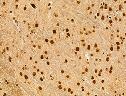 Invitrogen Phospho-AKT1 (Ser124) Polyclonal Antibody 100 &mu;L; Unconjugated:Antibodies,