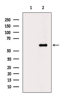 Invitrogen Phospho-OPRK1 (Tyr369) Polyclonal Antibody 100 &mu;L | Buy Online | Invitrogen&trade; | Fisher Scientific