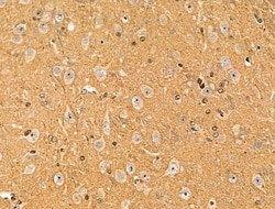 Invitrogen Phospho-VEGF Receptor 2 (Tyr1175) Polyclonal Antibody 100 μL;