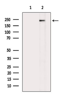Invitrogen Phospho-VEGF Receptor 2 (Tyr1175) Polyclonal Antibody 100 μL;