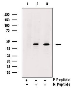 Invitrogen Phospho-Nkx2.1 (Ser327) Polyclonal Antibody 100 &mu;L | Buy Online | Invitrogen&trade; | Fisher Scientific