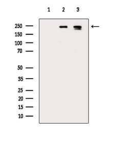 Invitrogen Phospho-TSC2 (Ser664) Polyclonal Antibody 100 &mu;L; Unconjugated:Antibodies,