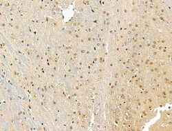Invitrogen Phospho-IRAK1 (Thr209) Polyclonal Antibody 100 &mu;L; Unconjugated:Antibodies,