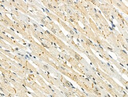 Invitrogen Phospho-IRAK1 (Thr209) Polyclonal Antibody 100 &mu;L; Unconjugated:Antibodies,