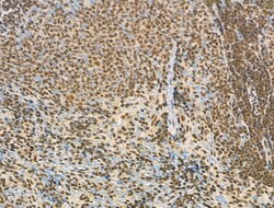 Invitrogen Phospho-IRAK1 (Thr209) Polyclonal Antibody 100 &mu;L; Unconjugated:Antibodies,