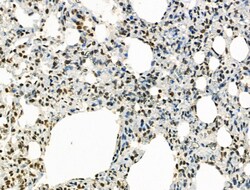 Invitrogen Phospho-IRAK1 (Thr209) Polyclonal Antibody 100 &mu;L; Unconjugated:Antibodies,