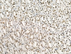 Invitrogen Phospho-IRAK1 (Thr209) Polyclonal Antibody 100 &mu;L; Unconjugated:Antibodies,