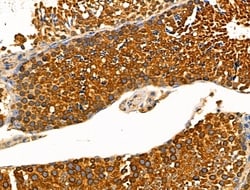 Invitrogen Phospho-KIF11 (Thr926) Polyclonal Antibody 100 &mu;L; Unconjugated:Antibodies,