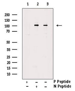 Invitrogen Phospho-VAV2 (Tyr142) Polyclonal Antibody 100 &mu;L | Buy Online | Invitrogen&trade; | Fisher Scientific