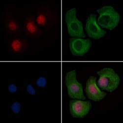 Invitrogen Phospho-FOXL2 (Ser238) Polyclonal Antibody 100 μL; Unconjugated:Antibodies,