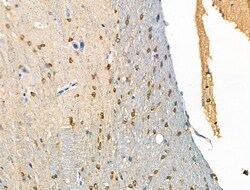 Invitrogen Phospho-FOXL2 (Ser238) Polyclonal Antibody 100 μL; Unconjugated:Antibodies,