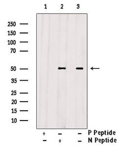 Invitrogen Phospho-FOXL2 (Ser238) Polyclonal Antibody 100 μL; Unconjugated:Antibodies,