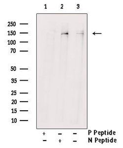 Invitrogen Phospho-PLCB3 (Ser537) Polyclonal Antibody 100 &mu;L; Unconjugated:Antibodies,