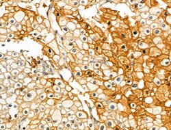 Invitrogen Phospho-PKC delta (Ser645) Polyclonal Antibody 100 &mu;L | Buy Online | Invitrogen&trade; | Fisher Scientific