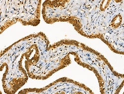 Invitrogen Phospho-PKC delta (Ser645) Polyclonal Antibody 100 &mu;L | Buy Online | Invitrogen&trade; | Fisher Scientific