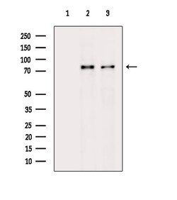 Invitrogen Phospho-PKC delta (Ser645) Polyclonal Antibody 100 &mu;L | Buy Online | Invitrogen&trade; | Fisher Scientific