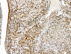 Invitrogen Phospho-MCL-1 (Ser64) Polyclonal Antibody 100 μL; Unconjugated:Antibodies,