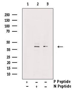 Invitrogen Phospho-MCL-1 (Ser64) Polyclonal Antibody 100 μL; Unconjugated:Antibodies,