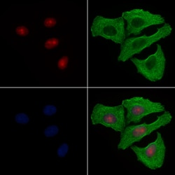 Invitrogen Phospho-53BP1 (Ser1618) Polyclonal Antibody 100 μL; Unconjugated:Antibodies,