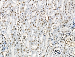 Invitrogen Phospho-53BP1 (Ser1618) Polyclonal Antibody 100 μL; Unconjugated:Antibodies,