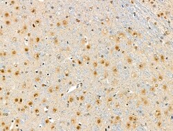 Invitrogen Phospho-53BP1 (Ser1618) Polyclonal Antibody 100 μL; Unconjugated:Antibodies,