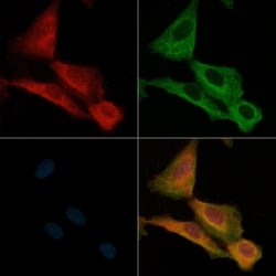 Invitrogen Phospho-SLP76 (Ser376) Polyclonal Antibody 100 &mu;L; Unconjugated:Antibodies,