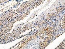 Invitrogen Phospho-SLP76 (Ser376) Polyclonal Antibody 100 &mu;L; Unconjugated:Antibodies,