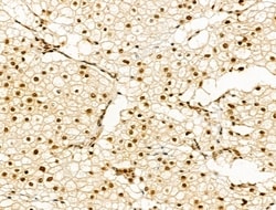 Invitrogen Phospho-PAK1/PAK2 (Thr423, Thr402) Polyclonal Antibody 100 &mu;L | Buy Online | Invitrogen&trade; | Fisher Scientific