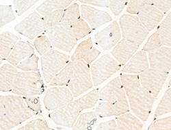 Invitrogen Phospho-PAK1/PAK2 (Thr423, Thr402) Polyclonal Antibody 100 &mu;L | Buy Online | Invitrogen&trade; | Fisher Scientific