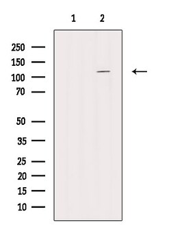 Invitrogen Phospho-PLD1 (Thr147) Polyclonal Antibody 100 &mu;L | Buy Online | Invitrogen&trade; | Fisher Scientific