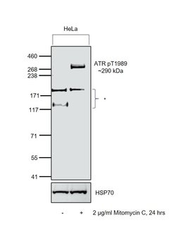 Invitrogen Phospho-ATR (Thr1989) Polyclonal Antibody 100 &mu;L; Unconjugated:Antibodies,