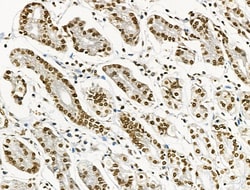 Invitrogen Phospho-BRK (Tyr447) Polyclonal Antibody 100 &mu;L; Unconjugated:Antibodies,