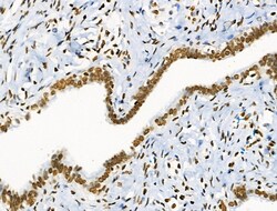 Invitrogen Phospho-BRK (Tyr447) Polyclonal Antibody 100 &mu;L; Unconjugated:Antibodies,