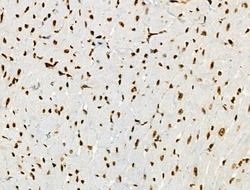 Invitrogen Phospho-BRK (Tyr447) Polyclonal Antibody 100 &mu;L; Unconjugated:Antibodies,